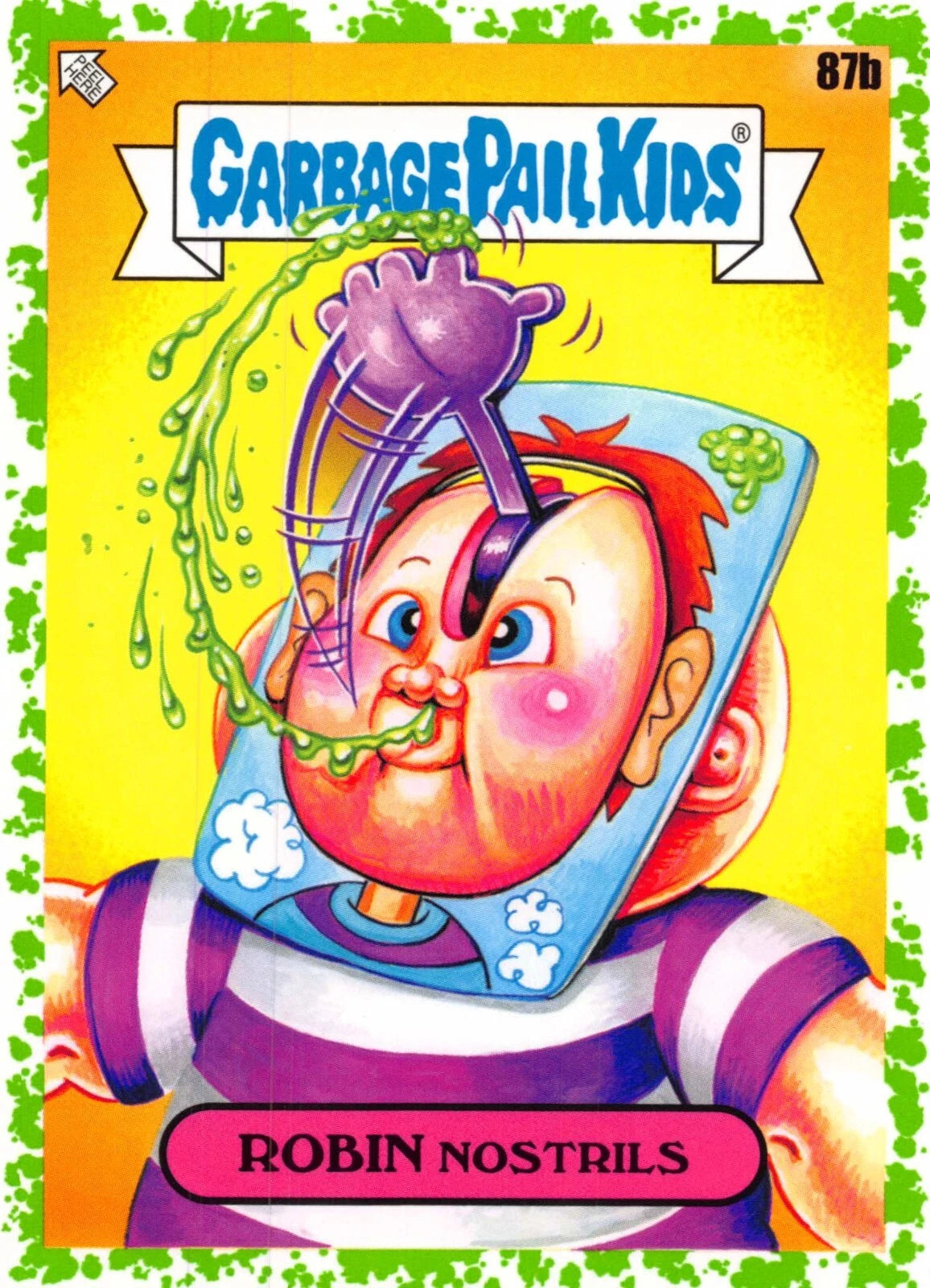 Robin Nostrils